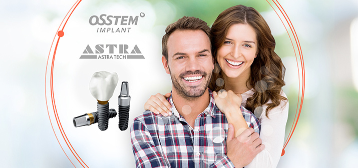 Имплантация зубов системами Astra Tech и Osstem