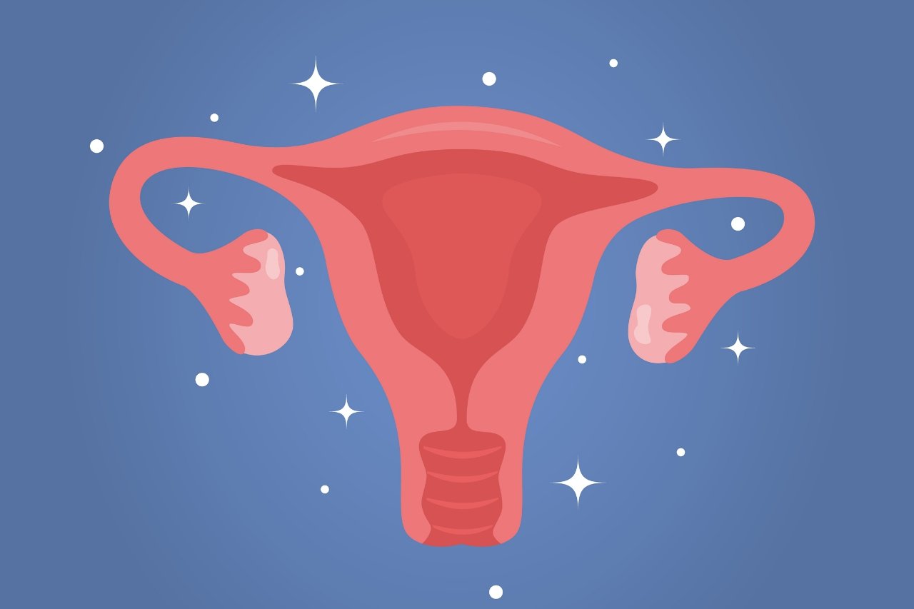 Радиоволновое лечение эрозии шейки матки