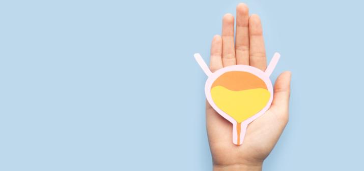 Инстилляция мочевого пузыря (женщины)