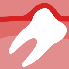 Дистопированные зубы: что делать