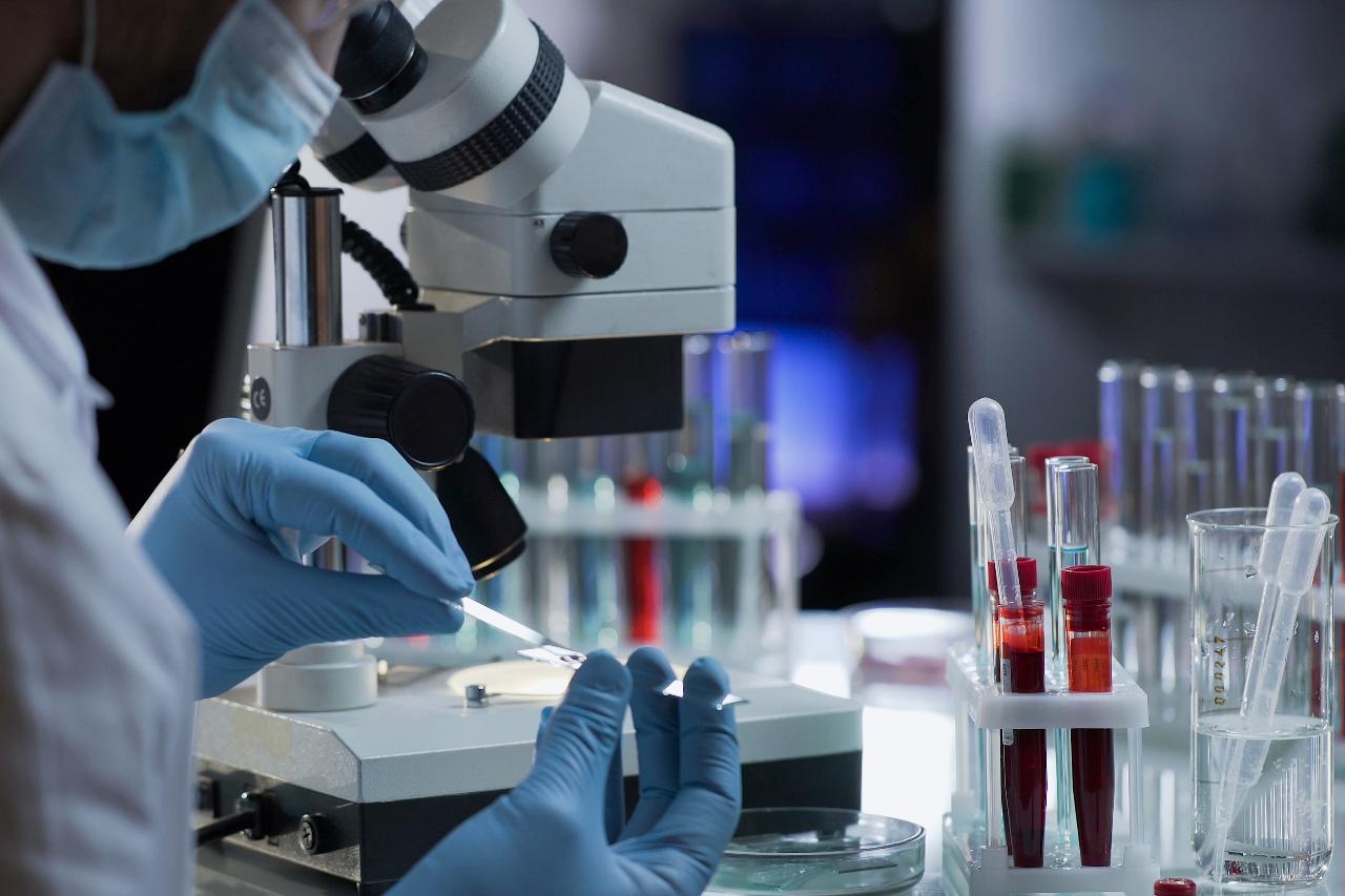 ПСА (простат-специфический антиген)