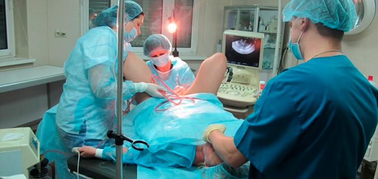 Визуализация раздела Гименопластика: особенности восстановления девственной плевы