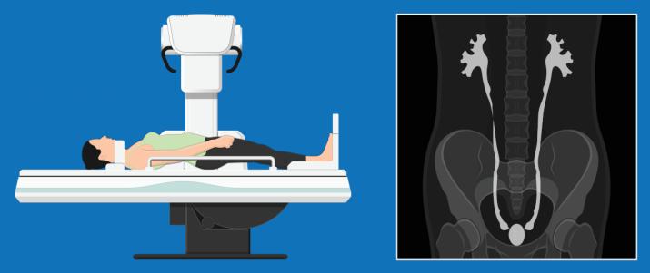 Пиелография