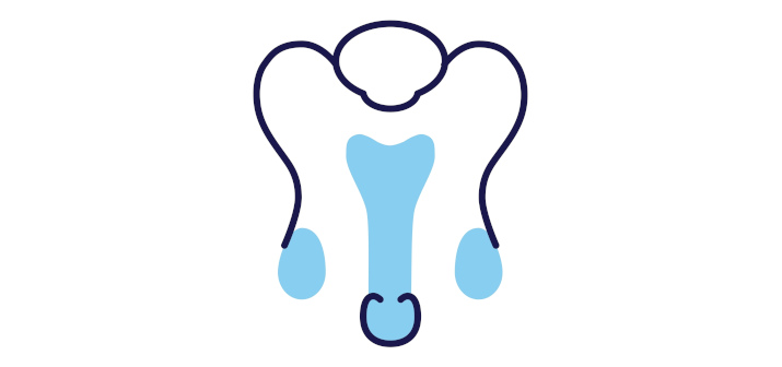 Водянка яичка