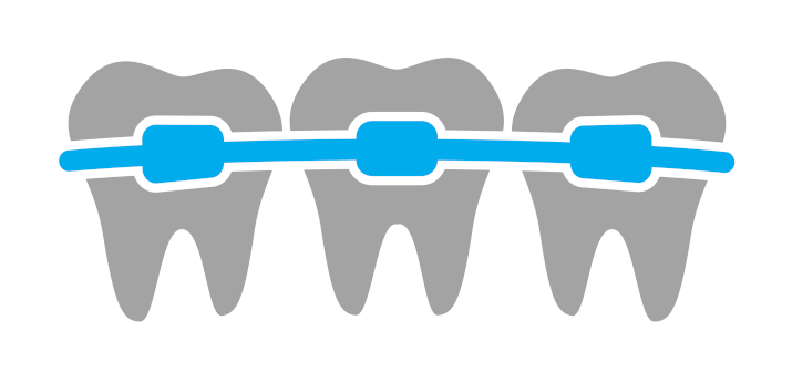 Гигиена полости рта при ортодонтическом лечении
