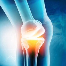 Травмы менисков коленного сустава