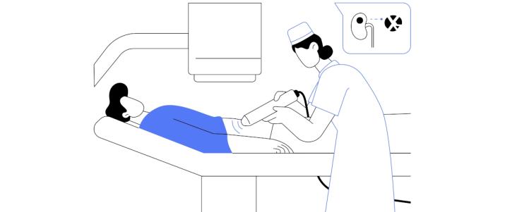 Удаление камней из мочеточника