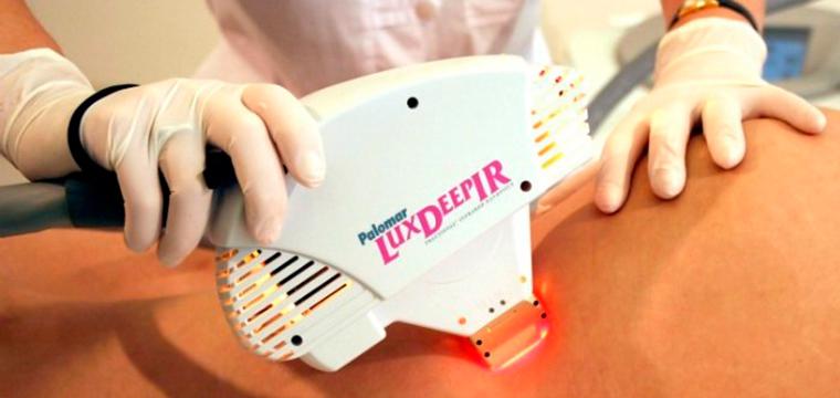 Визуализация раздела Термолифтинг тканей: Palomar Lux Deep IR в ГУТА КЛИНИК