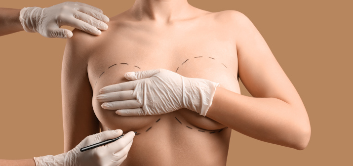 Что такое субмаммарный доступ, и как он используется в пластической хирургии?