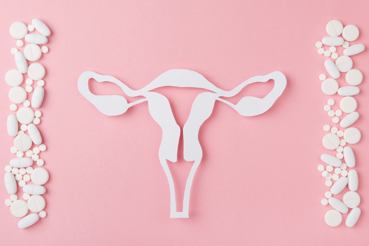 Удаление кисты яичников