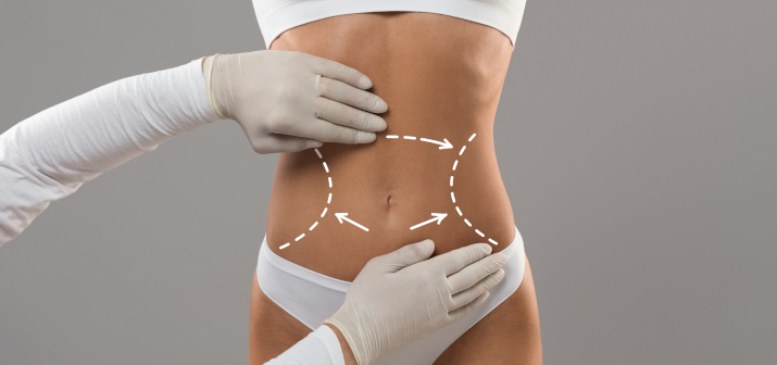 VASER-липосакция — в чем отличие от стандартных методик