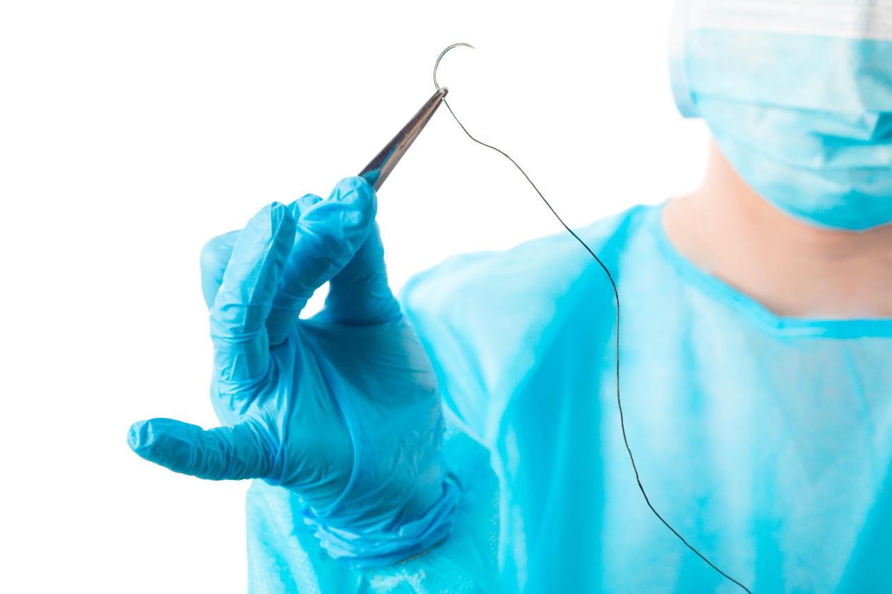 Удаление кисты яичка