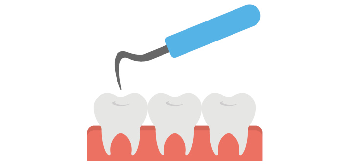 Эрозия эмали: почему эмаль разрушается, и как сохранить зубы