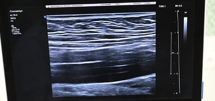 Мочекаменная болезнь, причины, осложнения