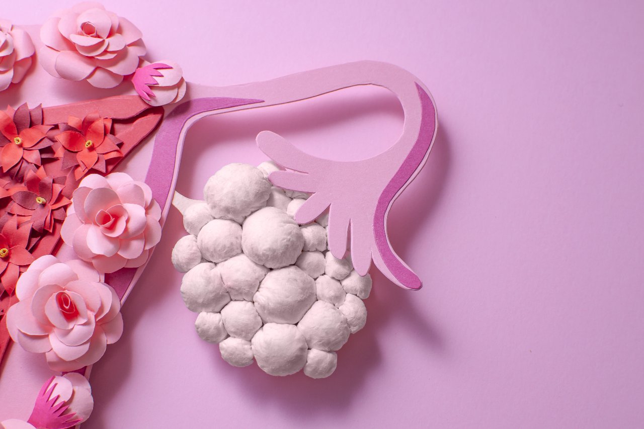 Лапароскопия маточных труб