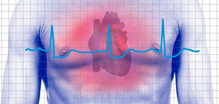 Причины возникновения аритмии сердца