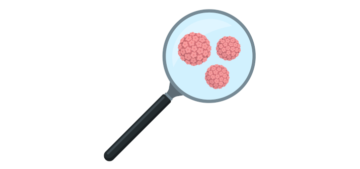 Как происходит лазерная деструкция папиллом