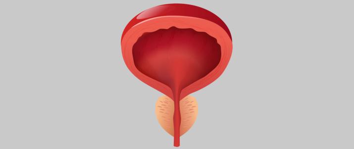 Аппаратное лечение хронического простатита