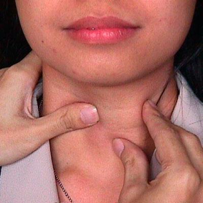 Узловой зоб - заболевание щитовидной железы