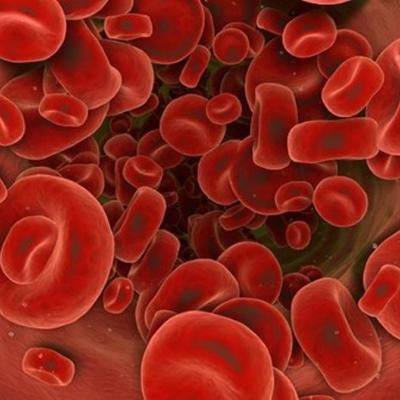Визуализация Гемохроматоз: все, что нужно знать о нарушениях обмена железа в организме