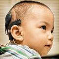 коррекция слуха с помощью кохлеарной имплантации