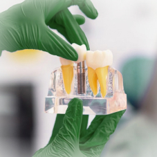 Имплантация зуба за 53 980 ₽ Имплантация зуба за 53 980 ₽